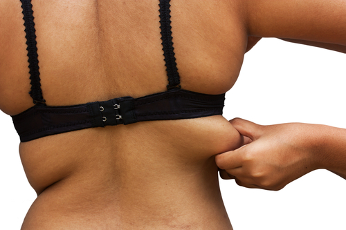 5 Methods for Back Fat and Bra Bulge Removal