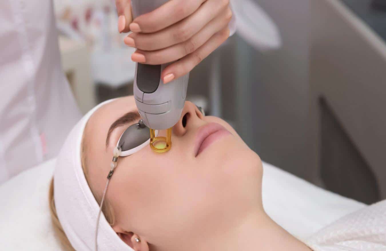 Pulse Light Clinic - Our clients recovery journey with CO2 laser for acne  scar removal ​- ​What is the CO2 Laser? - The CO2 laser is a fractional  treatment for skin rejuvenation